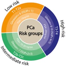 Understanding Risk Categories in Prostate Cancer