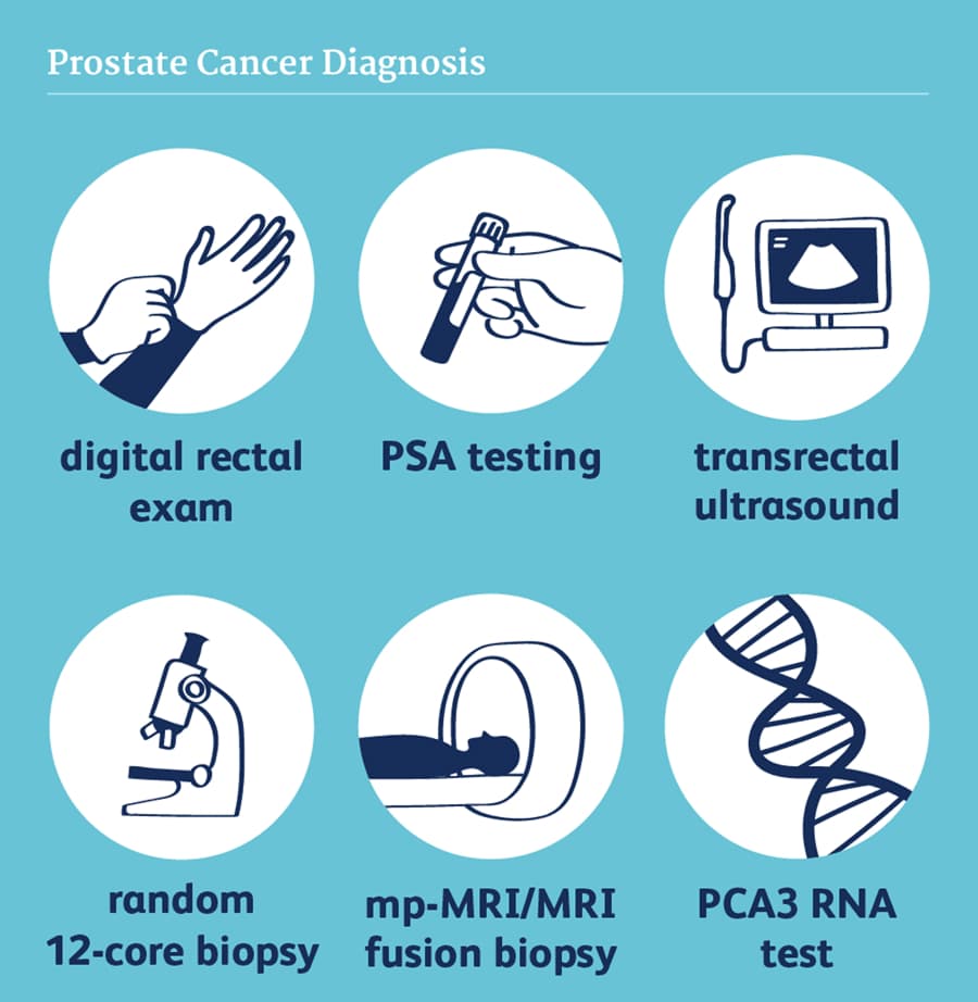 Tests Used for Prostate Cancer Screening